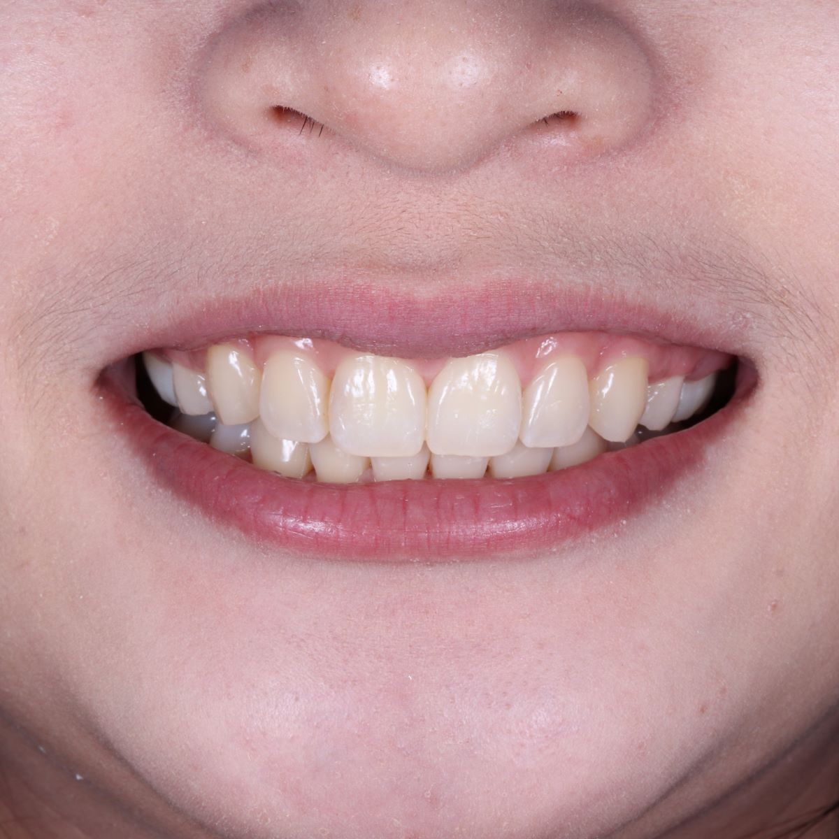 beautiful smile